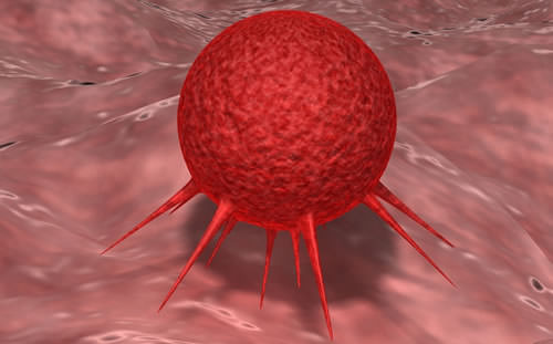 Advances Made in Immune Therapy Against Cervical Cancer